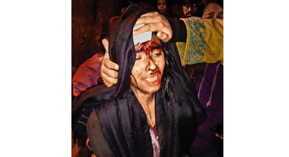 घायल छात्र संघ अध्यक्ष ओइशी घोष